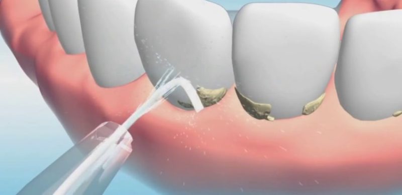 Válassza ki az öntözőberendezést
