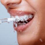 Irrigator - válassza ki a megfelelőt