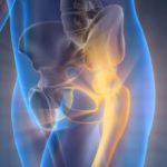 Hogyan válasszuk ki a megfelelő vitaminokat a csontokhoz