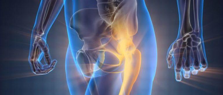 Hogyan válasszuk ki a megfelelő vitaminokat a csontokhoz