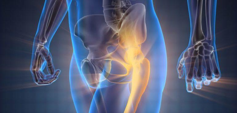 Hogyan válasszuk ki a megfelelő vitaminokat a csontokhoz